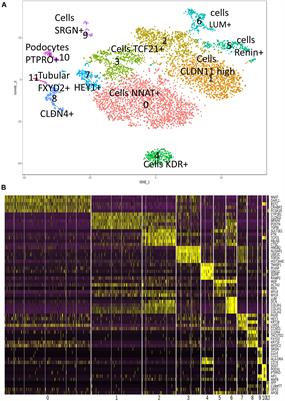 Detection of Hematopoietic Stem Cell Transcriptome in Human Fetal Kidneys and Kidney Organoids Derived From Human Induced Pluripotent Stem Cells